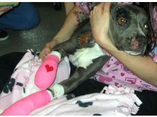 Valentine recovering from her injuries before  receiving prostheticsfor her injured limbs