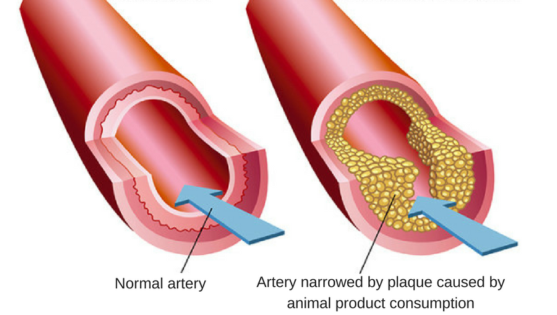 Normal artery